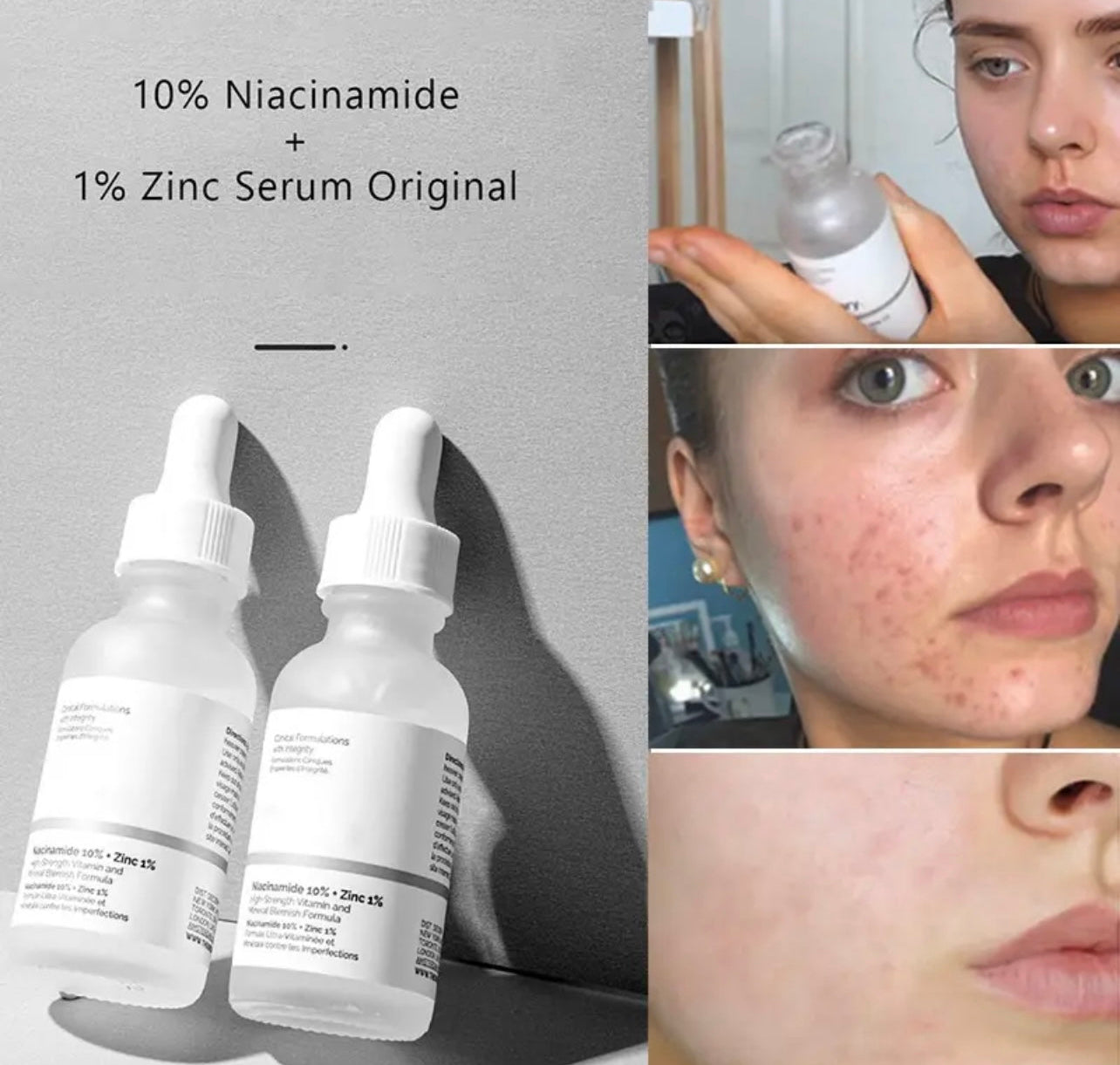 The Ordinary Niacinamide 10% + Zinc 1%