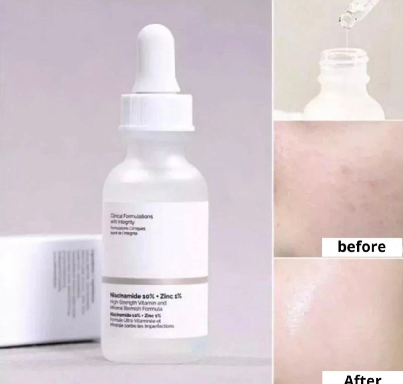 The Ordinary Niacinamide 10% + Zinc 1%